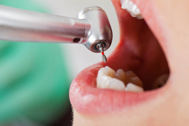 Best Pediatric Emergency Dentist in Northbrook, OH